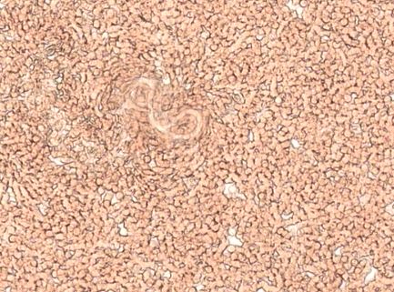 Microscopic bacteria.