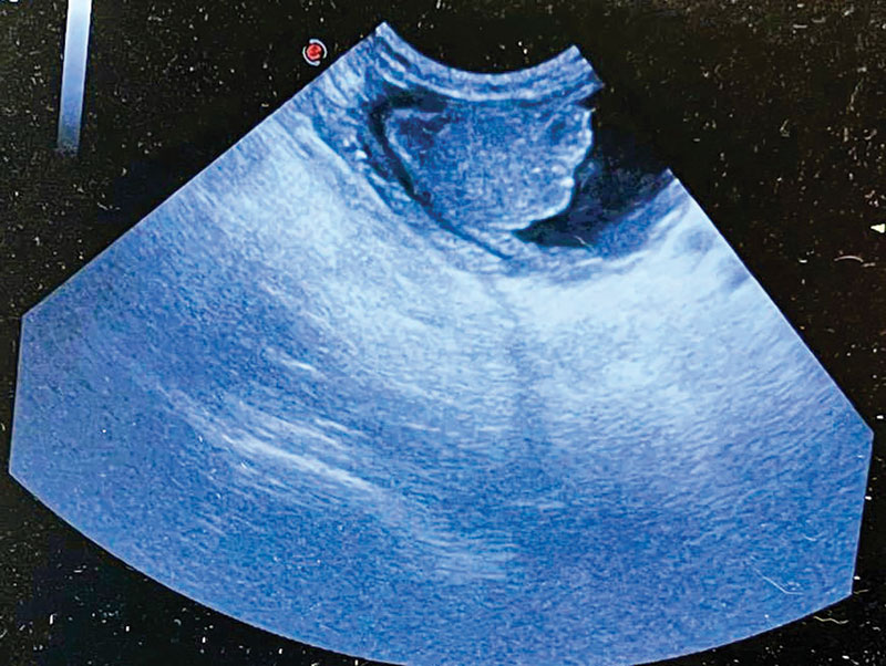 ultrasound image
