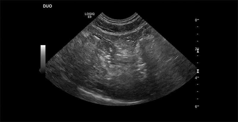 ultrasound image