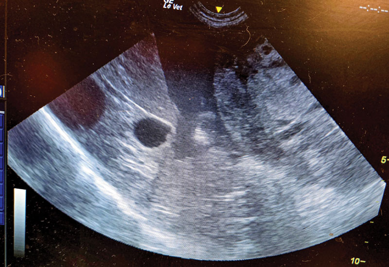 ultrasound image