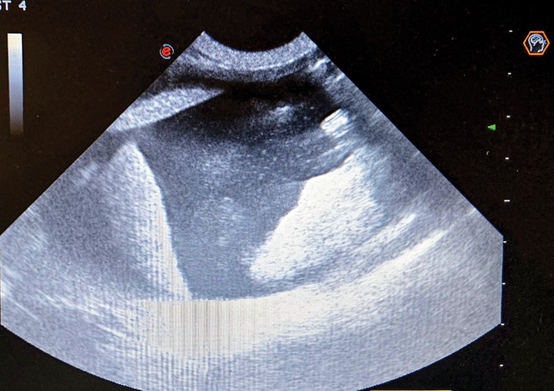 ultrasound image