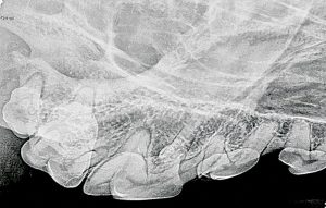 teeth x-ray